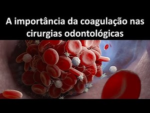 A importancia da coagulação nas cirurgias odontológicas | Odontologia | Dra Bianca Rosa
