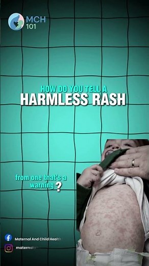 Cutis Marmorata vs. Livedo Reticularis: Harmless Rash or Warning Sign?