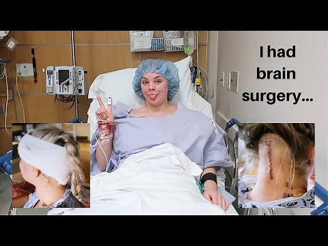 I had brain surgery | chiari malformation decompression
