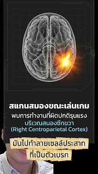 EP 7. เล่นซูโดกุอยู่ดี ๆ ทำไมถึงชักได้?! - วันละโรค