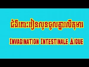 IIA# invagination intestinale aigue#ពោះវៀនលូនចូលគ្នា