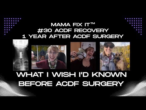 #30 ACDF Recovery What I Wish I’d Known Before ACDF Surgery | 1 Year ACDF Recovery Update