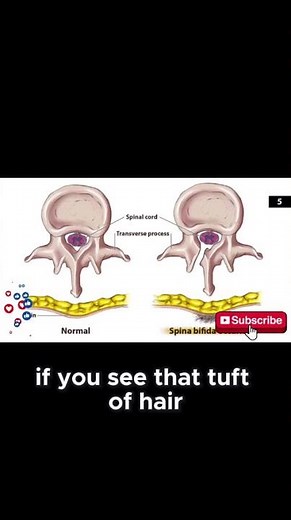 USMLE Step 1 High Yield | First Aid Rapid Review Facts You Must Know