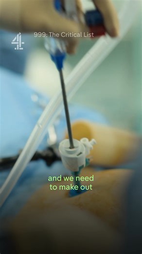 126K views · 1.2K reactions | Part 2: Doctors Make Concerning Discovery During Emergency Surgery | The Critical List | Channel 4 | Facebook