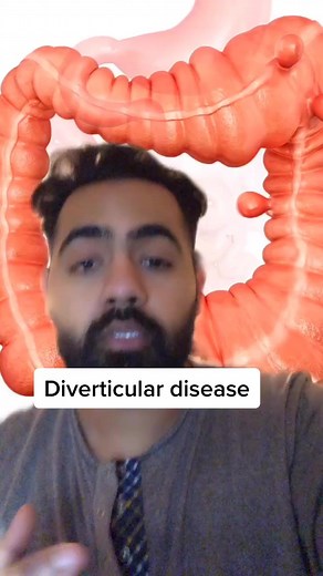 Understanding Diverticular Disease: Symptoms, Causes, and Treatment Options