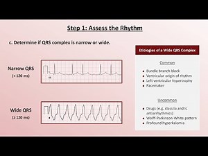 Intro to EKG Interpretation - A Systematic Approach • Video • MEDtube.net