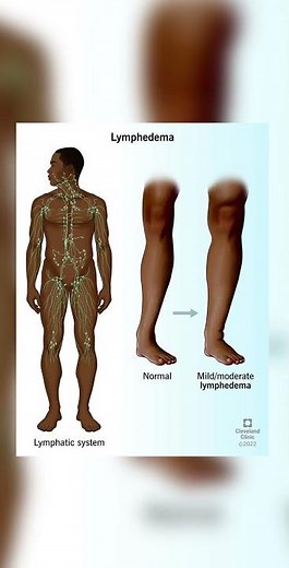 Disorders