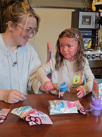 Ichthyosis explained: what is ichthyosis & sensory tips