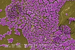 Antibiotic overuse may give bacteria an evolutionary boost