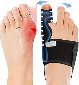 Bunion Corrector Men & Women: 2 Pcs Big Toe Straightener for Bunion Relief - Adjustable Orthopedic Hallux Valgus Corrector for Bunion Splint - Day/Night Support (Black)