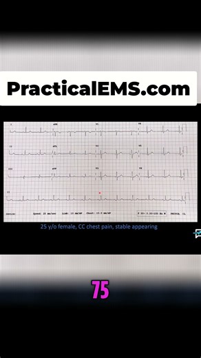 EKG Box Method: Quick Heart Rate Analysis for Medical Professionals! #shorts