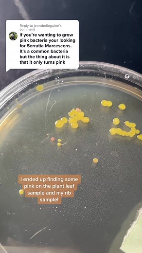 Identifying Serratia Marcescens: Pink Samples Found