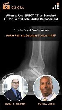 When to Use SPECT-CT vs Standard CT for Painful Total Ankle Replacement