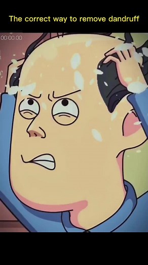 Effective Methods for Removing Dandruff from Hair