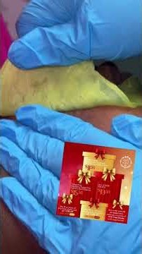 Upper Lip & Chin Waxing with Sexy Smooth Lemon Kiss Hard Wax by ‪@waxingqueenadventures‬