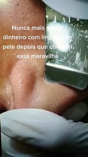 Limpeza de pele eu faço em casa agora.