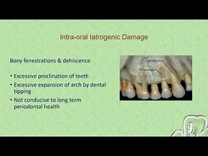 Deleterious Effects of Orthodontic Treatment