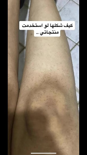 KHالعناية والجمآل ✨ على TikTok