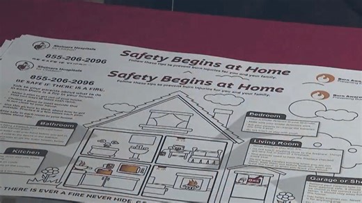 National Burn Awareness Week; how to prevent common burns