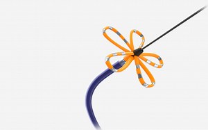 FARAPULSE PFA导管（波士顿科学）