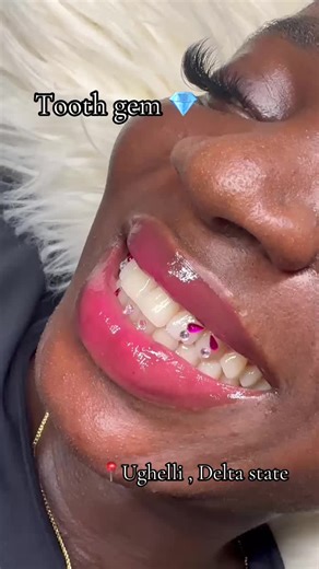Beautify your smile with allura tooth gems 💎 #fy #viral #creatorsearchinsight