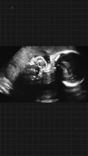 Your dream of parenthood matters — and so does the support you receive along the way. IVF London combines leading fertility expertise with a truly personal approach. Book a FREE 15-Minute Private Consultation today to speak directly with a specialist, understand your options, and move forward at your own pace. | IVF london