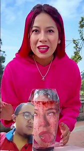 prank besties bleeding head 😱#shorts#funny#homepage#reaction#viral#like#subscribe#pranklife#fyp#usa