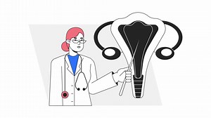 Gynecology doctor animation. Animated gynaecologist, obgyn 2D cartoon flat colour line character. Obstetrics specialist 4K video concept footage on white with alpha channel transparency for web design