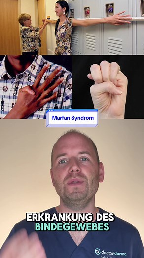 Marfan-Syndrom: Symptome und Früherkennung
