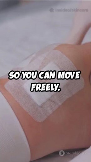 Smart Hydrogel Dressings: Skin-Adaptable, Stretchable Innovation for Infection-Free Wound Healing