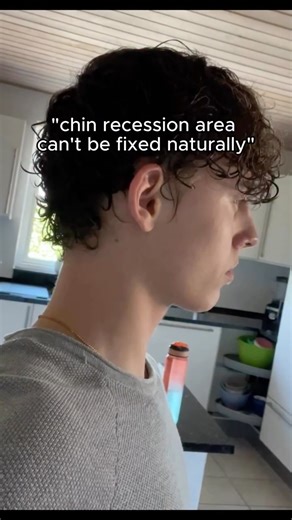 Oliver Jensen | ❌ 99% of people think surgery is the only way to fix this, but here’s the truth… ✅ Your face has muscles just like your body, and when... | Instagram