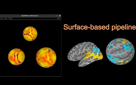 表层空间(surface-based)fMRI处理:01 freesurfer的recon-all 映射表层空间 freeview 查看大脑皮层