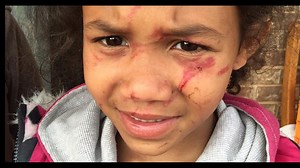 6-year-old attacked by 5th grader in school bathroom