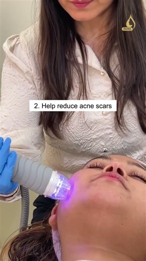 MNRF Treatment for Acne Scars & Open Pores | Boost Collagen Naturally | Dermatologist Explains