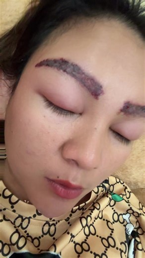 kartika puspita ayu (@kartika.1993)’s video of Alis Eyebrow