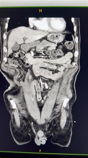 @neuviz glory 256 Neusoft Medical Systems Europe | oresti radaku