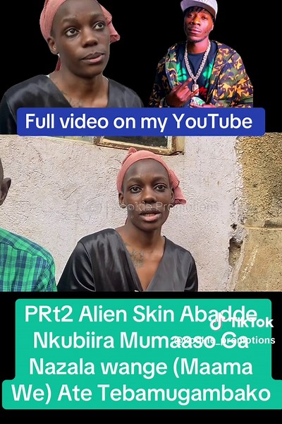 PRt2 Alien Skin Abadde Nkubiira Mumaaso Ga Nazala