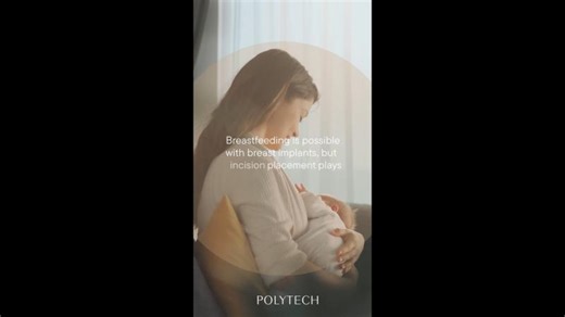 Breastfeeding with breast implants - what you need to know! | POLYTECH Mexico