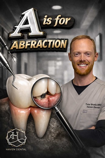 A is for Abfraction. Ever notice a sharp “chip” right at the gum line and wonder where it came from? That’s abfraction — not a cavity, not decay, but stress on the tooth over time. Clenching, grinding, and bite forces can literally flex a tooth and cause a hard-edged defect at the gum line. It can look small, but it can be sensitive and get worse if ignored. In this series, I’m breaking dentistry down A–Z so you actually understand what’s happening in your mouth — no fear tactics, no fluff. If y