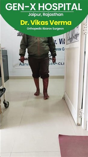 Ilizarov Surgery: Before and After Results#shortsfeed #shorts