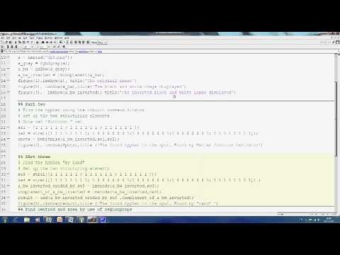 BwHitMiss in Matlab (Hit Miss)