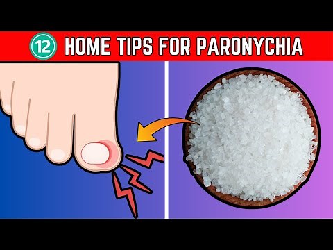 12 Essential Home Tips for Treating Paronychia: A Comprehensive Guide | The Health Place