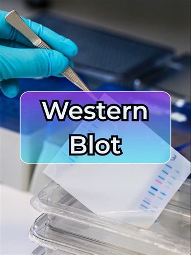 Introducción al Western Blot en Biología Molecular