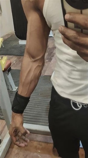 fore arms