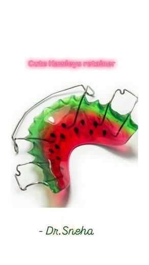 😱😍 Cute retainer after braces treatment #hyderabaddentist #dentist #trend #bracesoff #braces