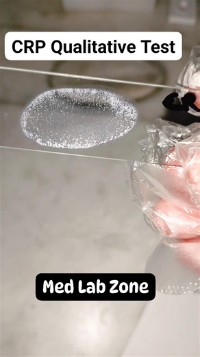 1.9K views · 13 reactions | CRP Qualitative Test!! What it is Meaning Positive CRP?? What will be expected Quantitative result? For full video join us on Youtube https://youtube.com/@medlabzone98?si=I0yMiX0eN9TkO0Xk #followerseveryonehighlights #fbreelsfypシ゚viralシ #viralchallenge2025 #followerseveryone #fypシviralシ #mariachiinfantiltapatio #mariachijuveniltapatio #medical #microscopy #MedicalLabScientists | MED LAB ZONE | Facebook