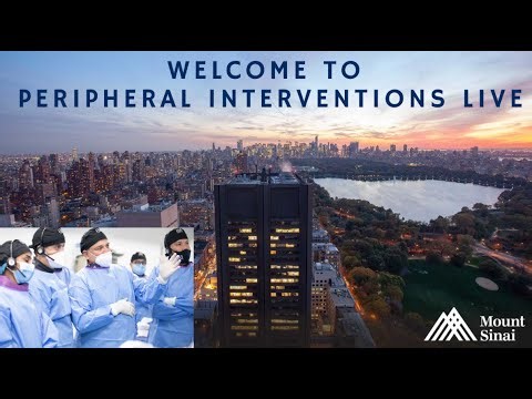 Watch Live Common Femoral Artery Intervention
