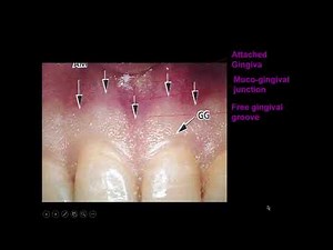 periodontology chart demonstration