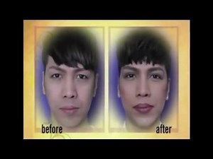 Double eyelid surgery is the solution for droopy and sad eyes ! Here’s our unkabogable @praybeytbenjamin who did the double eyelid surgery a few years back because he believes in aging gracefully . Amen to that , Vice ! - What is double eyelid surgery? Aging loose skin is removed using a carbon dioxide laser to cut through the skin . Advantages of using a laser means no bleeding which equals less bruising and faster healing time - For inquiries please call ☎️819-2356 or email us at info@belomed.