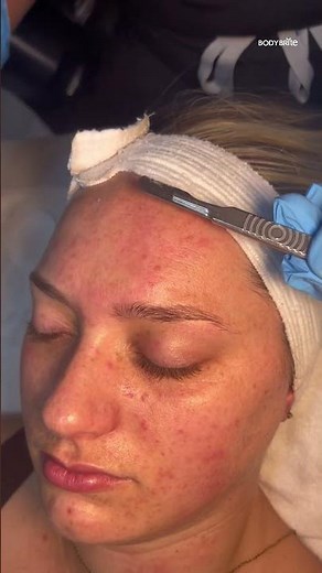 Dermaplane = Smooth & Glowing Skin!